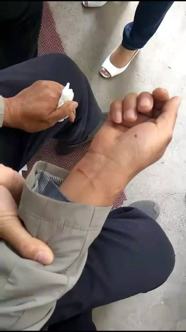 滚球预测赛后采访曝光，内幕引发热议的简单介绍